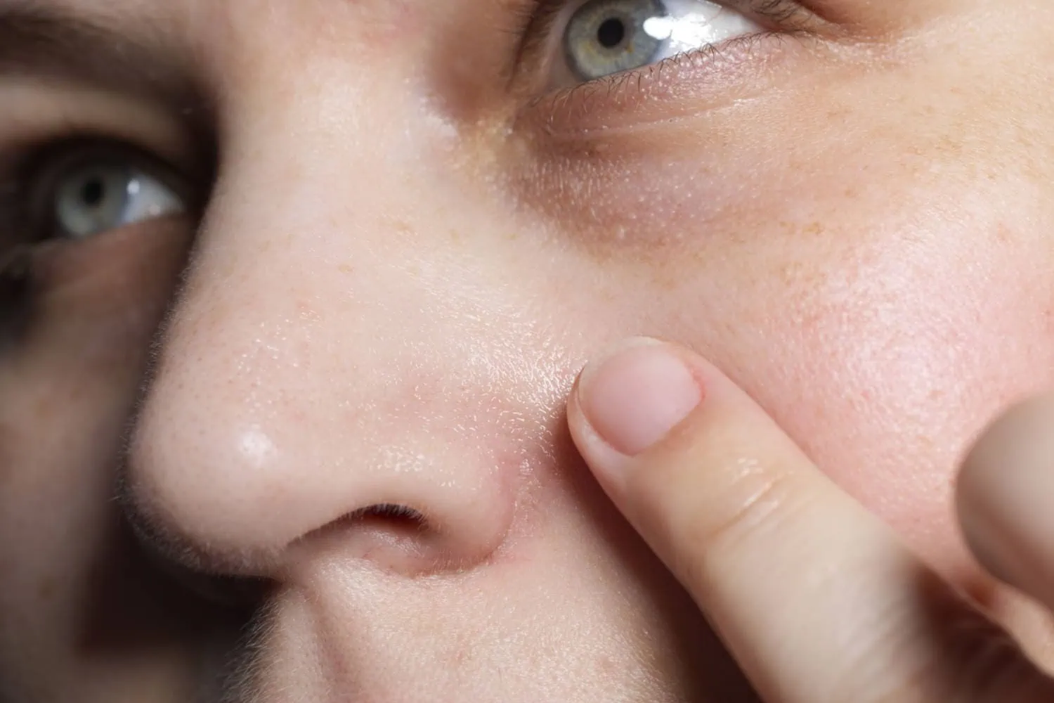 Gesichtspeeling Test: Paulas Choice Skin Perfecting 2 Bha Liquid Exfoliant Anwendung