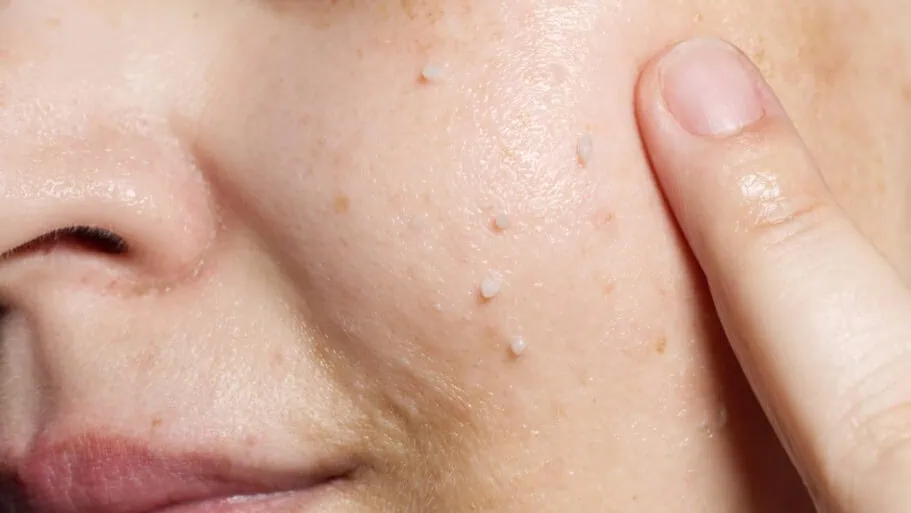 Das beste Gesichtspeeling 71 Gesichtspeeling Test: Zellulose Peeling